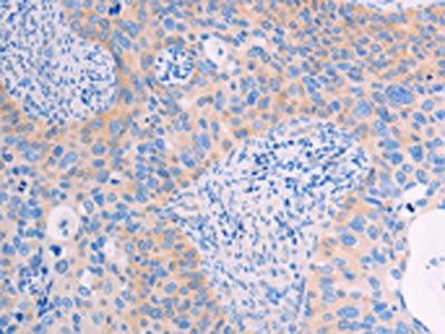 ADHFE1 Antibody