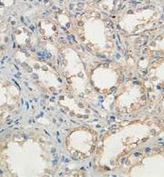 ADI1 Rabbit Polyclonal Antibody