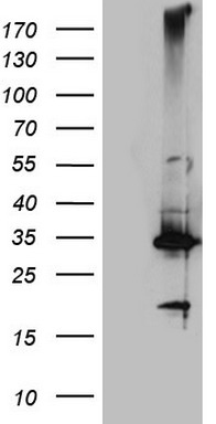 Adiponectin (ADIPOQ) antibody