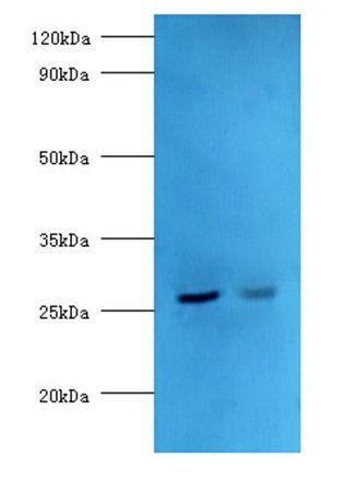 Adiponectin antibody