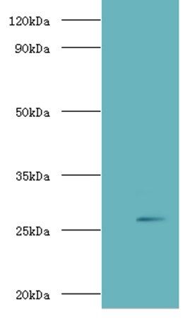 Adiponectin antibody