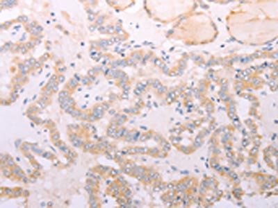 ADIPOR1 antibody