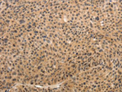 ADIPOR2 antibody