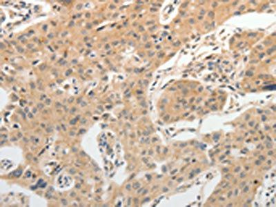 ADIPOR2 antibody