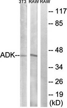 ADK Antibody