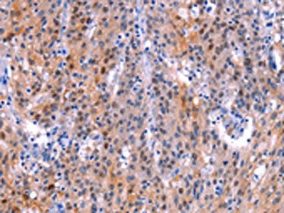 ADM2 Antibody