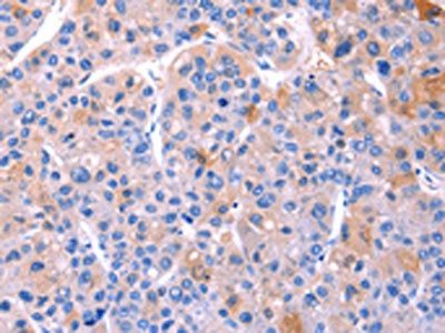 ADM2 Antibody