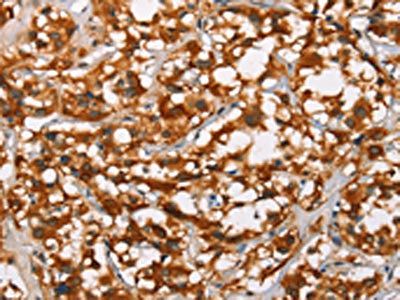 ADNP Antibody