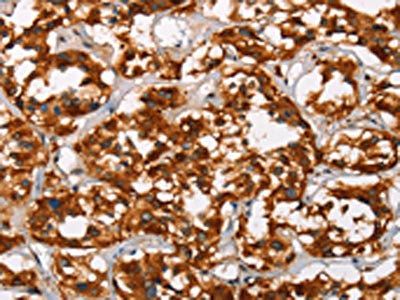 ADNP Antibody