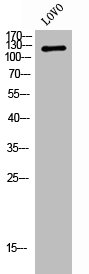 ADNP Antibody