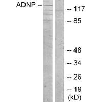 ADNP antibody