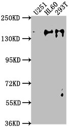 ADNP antibody