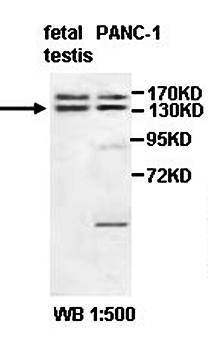 ADNP2 Rabbit Polyclonal Antibody