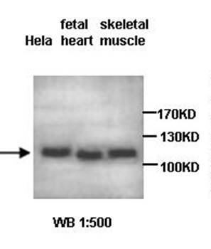 ADNP Rabbit Polyclonal Antibody