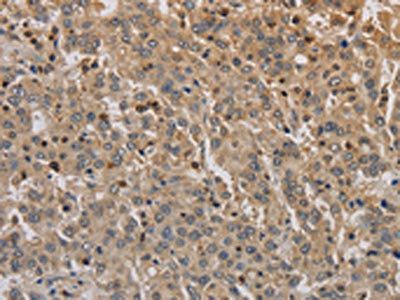 ADO Antibody