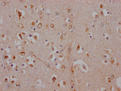 ADORA1 Recombinant Monoclonal Antibody