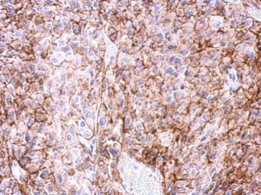 Adenosine A2a Receptor antibody [C2C3], C-term