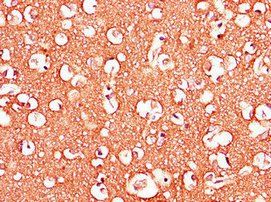 ADORA2B Antibody