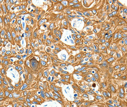ADORA3 Antibody