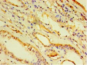 ADP-ribosylation factor 6 antibody