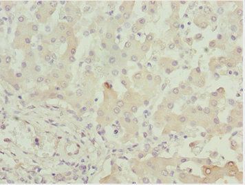 ADPGK Antibody