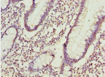 ADPGK Antibody