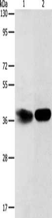 ADPRHL2 antibody