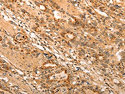 ADRA1B Antibody
