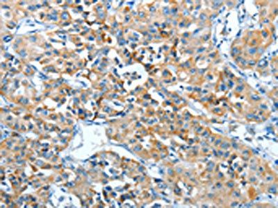 ADRA1B Antibody