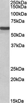 Goat anti-ADRA1B Antibody
