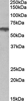 ADRA1B antibody