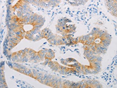 ADRB2 Antibody