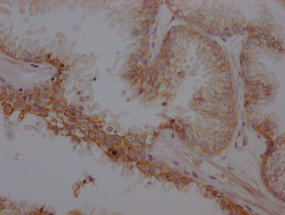 ADRB2 Recombinant Monoclonal Antibody