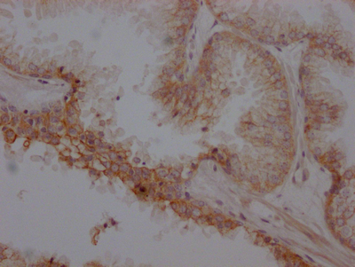 ADRB2 antibody