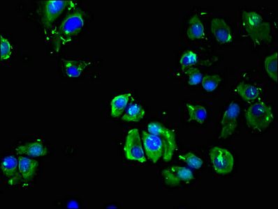 ADRB3 Antibody