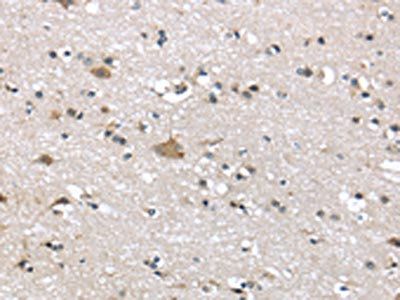 ADRB3 Antibody