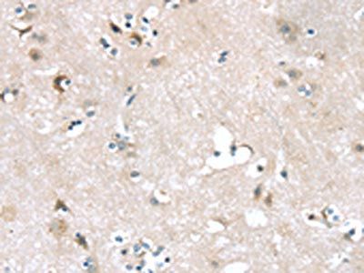 ADRB3 Antibody