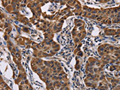 ADRBK2 Antibody