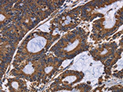 ADRBK2 Antibody
