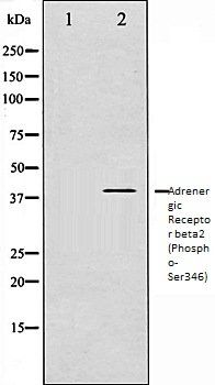 ADRB2 (Phospho-Ser346) antibody