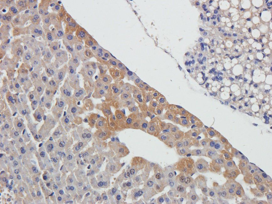 Adrenomedullin antibody