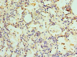 ADSL Antibody
