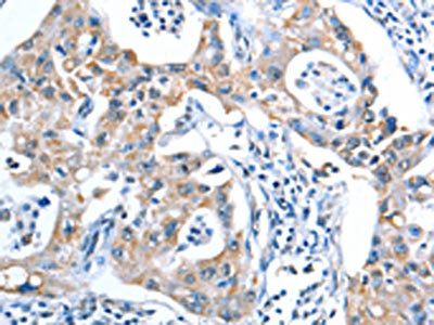 ADSL Antibody
