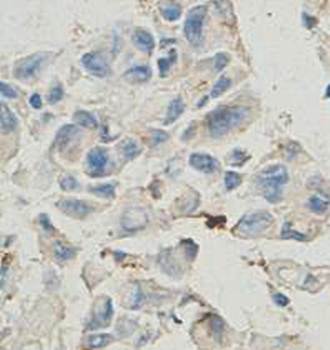 ADSL Rabbit Polyclonal Antibody