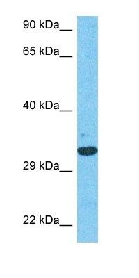 ADT3 antibody