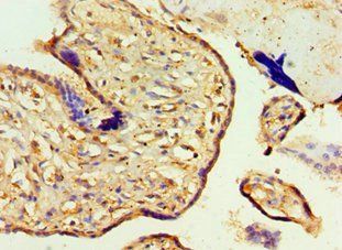 AEBP2 Antibody