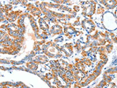 AEBP2 Antibody