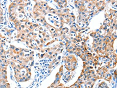 AEBP2 Antibody