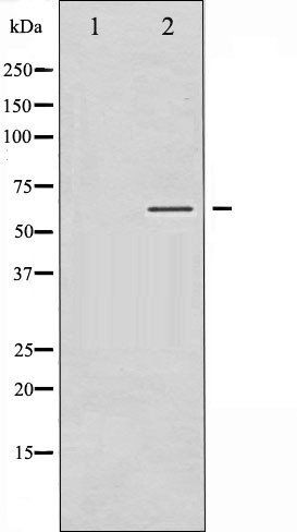 SGK (Phospho-Ser422) antibody