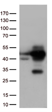 AFAP (AFAP1) antibody